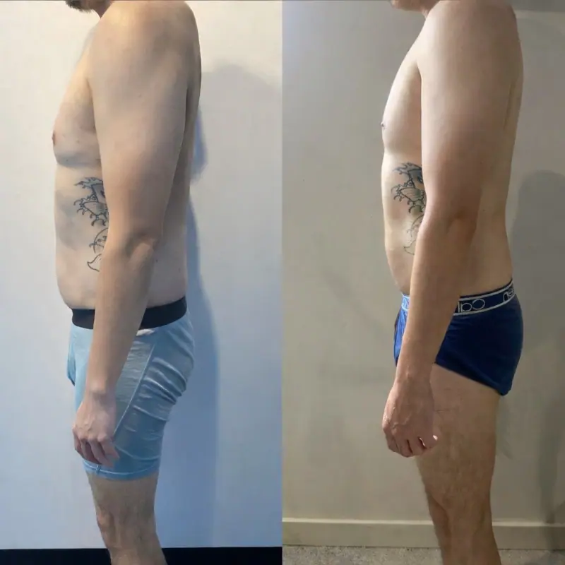 Wonder Axon body sculpting results — Full Body